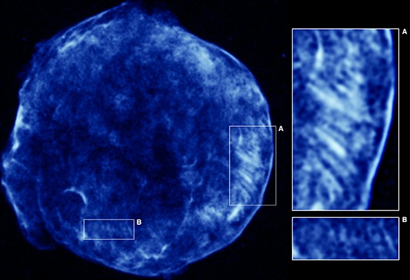 Остатки сверхновой SN 1572 в рентгеновском диапазоне. Отдельно выделены регионы с "полосами" отвественных за происхождение высокоэнергетичных космических лучей Иллюстрация NASA / CXC / Rutgers / K.Eriksen et al.